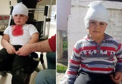 Sevmek istediği Pitbull melezi, hastanelik etti