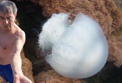 'Denizanası çarpmasında tatlı su dökmeyin'