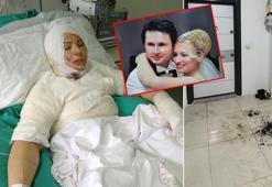 Ateşe verdiği eski eşi Elvan'ı yanarken izlemiş