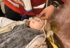 Kiev’den gelen 7 aylık Asia, UMKE Sahra Hastanesi’nde tedavi edildi