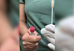 Hacettepe'den rahim ağzı kanserinin tespiti için test kiti