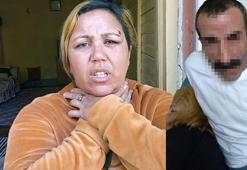 Sevgilisinin öldüresiye dövdüğü Güneş: 15 yaşında 100 mark karşılığında evlendirildim