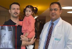 Cemre'nin bağırsaklarından 5 tane mıknatıslı bilye çıktı