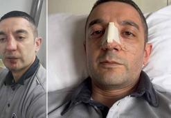 Bakırköy'de darbedilen güvenlik görevlisi: Hiçbir suçum yoktu