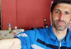 Futbol maçında dayak yiyen Suriyeli kaleci: Psikolojim bozuldu