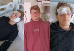 Arkadaşının silahla oynarken şakağından vurduğu liseli Alp, gözlerini kaybetti