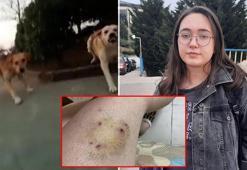 Kampüste köpek saldırısına uğradı