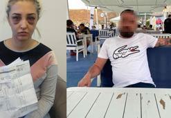 Gamze'nin darpla suçladığı eski sevgilisine cinsel saldırıdan da suç duyurusu