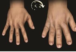 Doç. Dr. Özlem Haliloğlu: Akromegali hastalarında erken tanı için toplumsal farkındalık şart