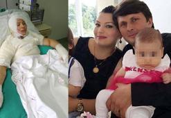 Elvan'ı yakan eski eşi: Olay kazayla oldu