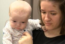 Yemek ve nefes borusu birbirine bağlı doğan minik Diar, Türkiye’de hayata tutundu