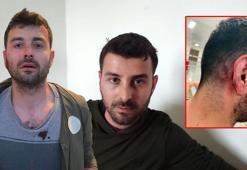 Futbolcu Veysel Sarı'nın kardeşiyle kiracıları karakolluk oldu