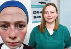Salgınla mücadelenin simgesi Seher hemşire: Maske kalktı ama izi ve hatıraları bizimle