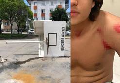 Smaçta devrilen potanın altında kalan Sefa, yaralandı