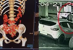 Urfi Çetinkaya'nın kardeşi ve yeğenine 'kapsül' gözaltısı