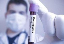 Koronavirüs salgınında günlük vaka sayısı 905 oldu