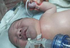 Doğum sırasında bebeğin köprücük kemiğinin kırıldığı iddiası