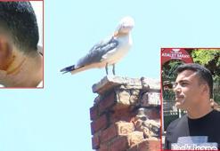 Kavgada ısırılarak koparılan kulağını martı kaptı