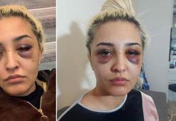 Eski sevgilisinden 3 saat şiddet gören Gamze, şikayetini geri çekti