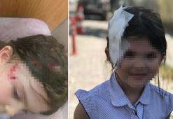 Gaziosmanpaşa'da pitbull saldırısına uğrayan çocuk kafasından yaralandı