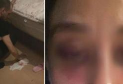 Sevgilisine şiddet uyguladığı iddia edilen Rubato’nun solisti davasında karar