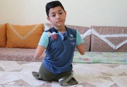 Kolları ve bacakları olmayan Nakşin, protez istiyor