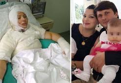 Eski eşinin yaktığı Elvan: Mangal yanıyormuş gibi canice izledi