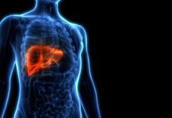 9 Haziran Uluslararası NASH Günü'nde karaciğer yağlanması hakkında önemli uyarılar