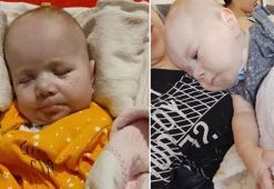 Ölümcül hastalıkla mücadele eden 7,5 aylık Poyraz kurtarılamadı