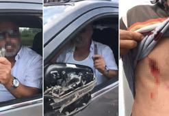 Trafikte tartıştığı 3 kişiyi falçatayla yaraladı, ‘Doğrarım’ diye tehdit etti