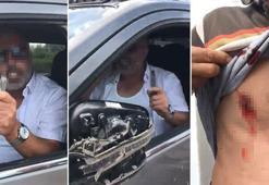 Sakarya'da falçatayla yaralanan sürücü: Niyeti öldürmekti