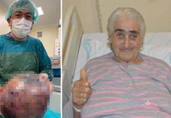 Nefes darlığı şikayetiyle gittiği hastanede karnından 10 kilo tümör çıkarıldı