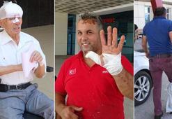 Yurt genelinde 5 bin 102 acemi kasap hastanelik oldu