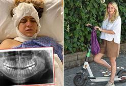 Uzmanlar uyardı; elektrikli skuter kazaları kafa travması ve ölümlere de neden oluyor