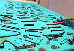 Nails, knives, tweezers: 158 pieces of metal were removed from the stomach of a woman