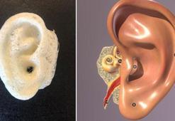 Akdeniz Üniversitesi Teknokent'te yapay dokuyla dış kulak yapıldı