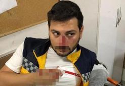 Şanlıurfa’da trafikte yol tartışmasında ambulans şoförünün burnu kırıldı: 1 gözaltı