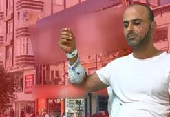 Lazer epilasyon sonrası 'yanık' suçlaması