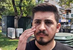 Hastanede hemşirenin burnunu kırdı, adli kontrolle serbest kaldı