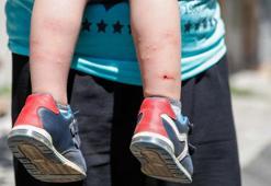 İstanbul'da 'Aedes' tehdidi