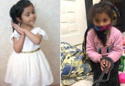 Pitbull saldırısında yaralanan Asiye'nin 'elleri bağlı' görüntüleri tepki çekti