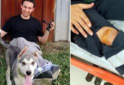 Acil serviste sağlık çalışanına makasla saldırdı