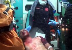 Sokakta karşılaştığı husumetlisini tabancanın kabzasıyla başından yaraladı