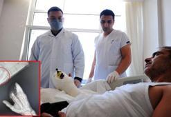Kopan parmaklarını poşetle hastaneye götürdü, 12 saatte dikildi