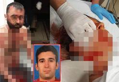 Meral ile 10 günlük eşini falçatayla yaralayan eski kocaya 40 yıla kadar hapis istemi