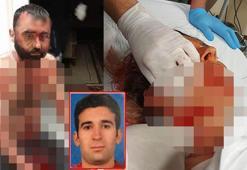 Meral ile 10 günlük eşini falçatayla yaralayan eski koca: İstesem öldürürdüm