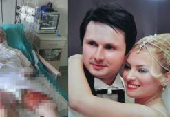 Eski eşinin yaktığı Elvan'a kati rapor istemi