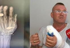 Büyükçekmece'de sıkışan oltayı çekerken balık kurşunu el kemiğine saplandı