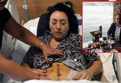 Eski sevgili dehşeti; midesinin yüzde 30'u alındı, vücuduna 135 dikiş atıldı