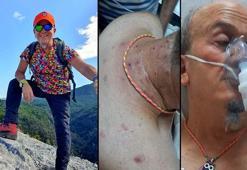 Yüzlerce arının saldırısına uğradı